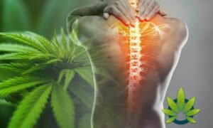 Cannabinoids for Back Pain The Benefits You Need to Know