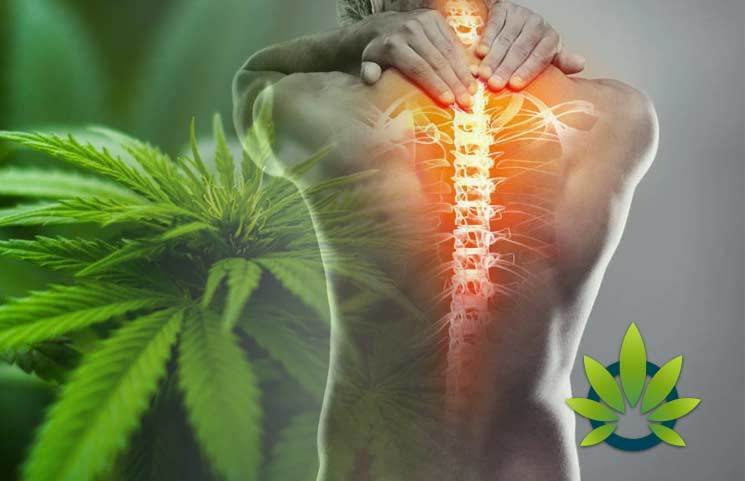 Cannabinoids for Back Pain The Benefits You Need to Know